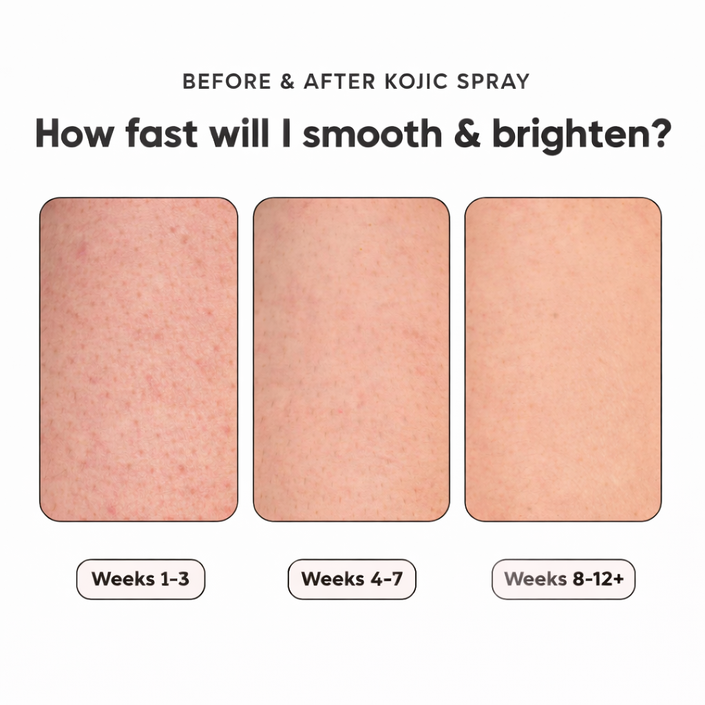 Kojic & Turmeric Body Spray