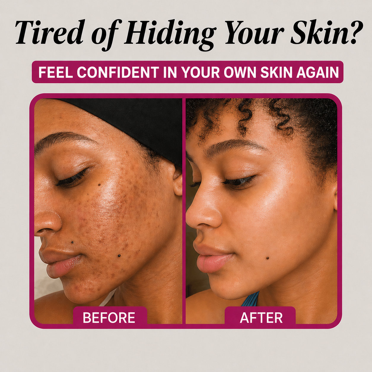 Arbutin Dark Spot Fading Cream
