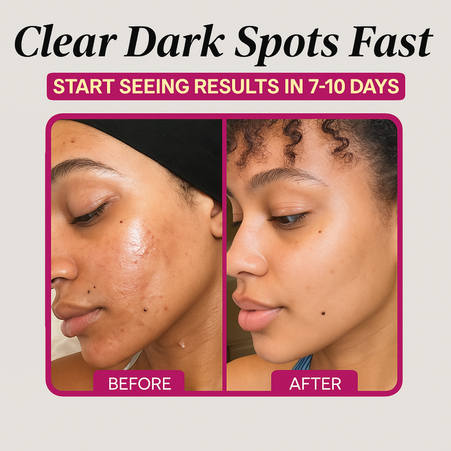 Arbutin Dark Spot & Hyperpigmentation Cream