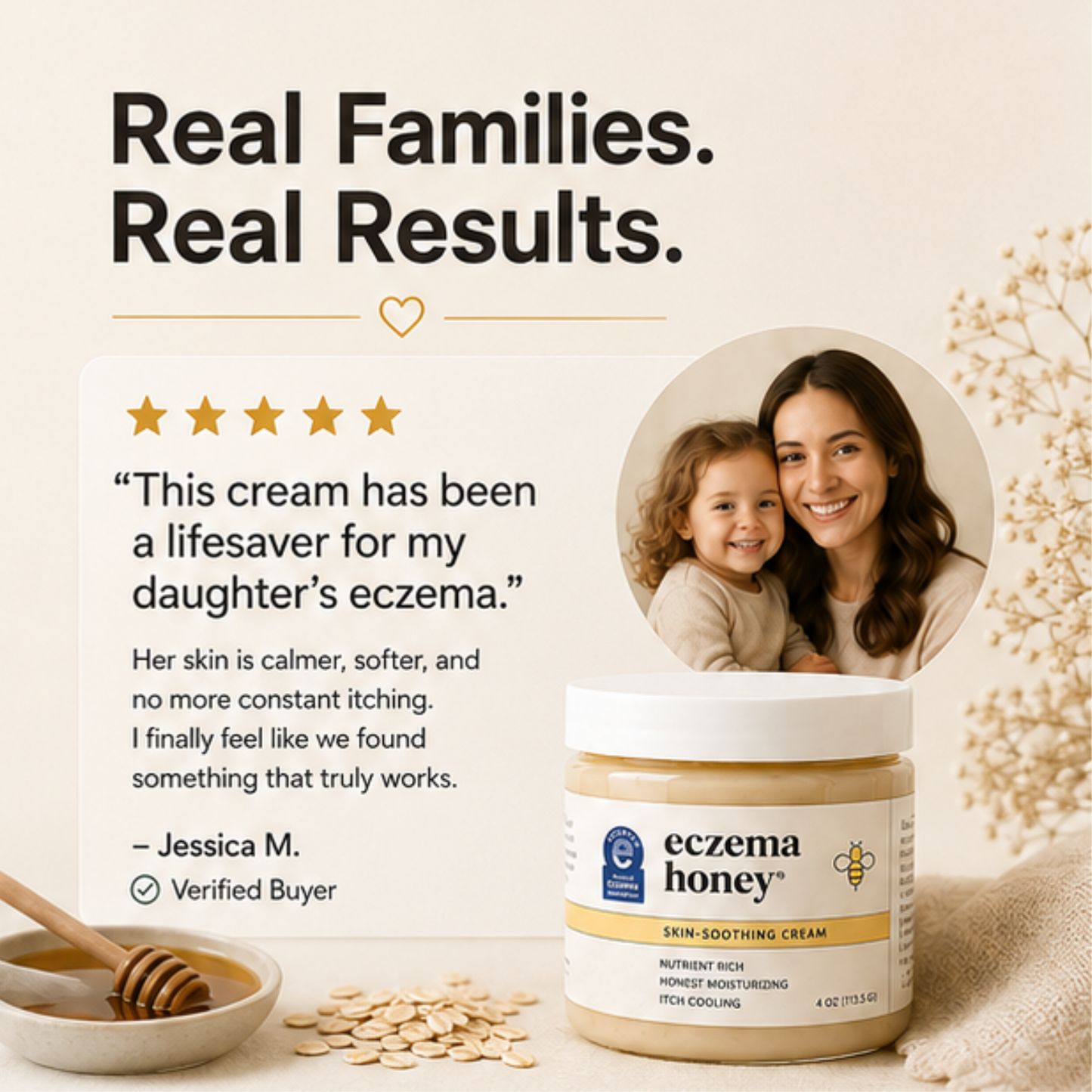 Eczema Honey Skin-Soothing Cream